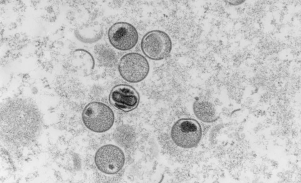 世衛(wèi)組織:全球超過18000例猴痘病例大部分在歐洲