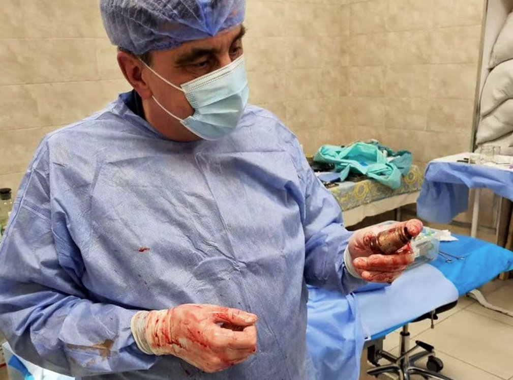 烏克蘭軍醫(yī)從士兵軀干上取出未爆炸的手榴彈