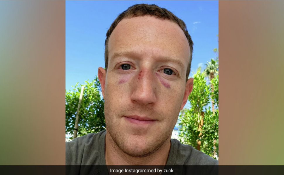 馬克·扎克伯格被教練打得鼻青臉腫